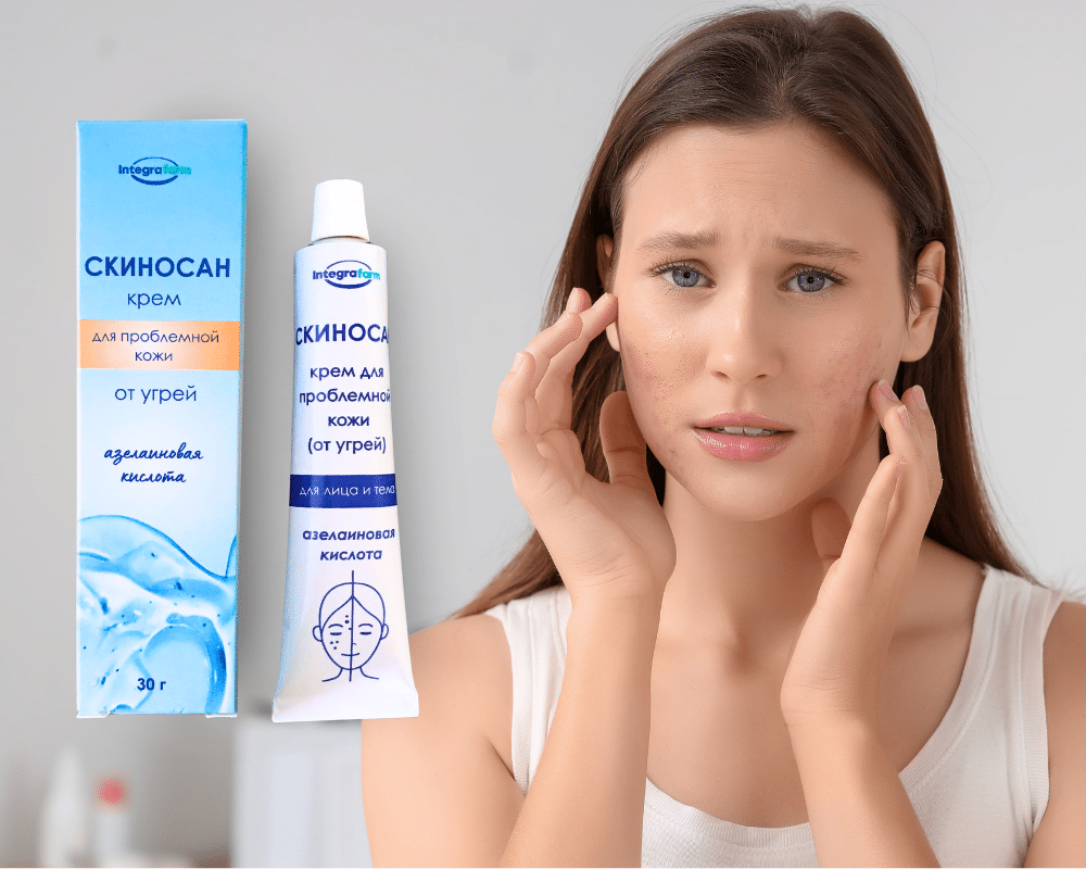 Крем Скиносан для проблемной кожи